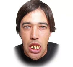Protesi con dente d'oro